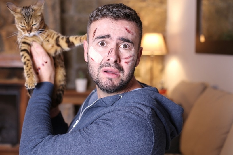 cat owner getting scratched by his pet cat