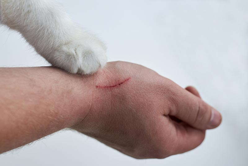 scratch on a man's hand made by a cat