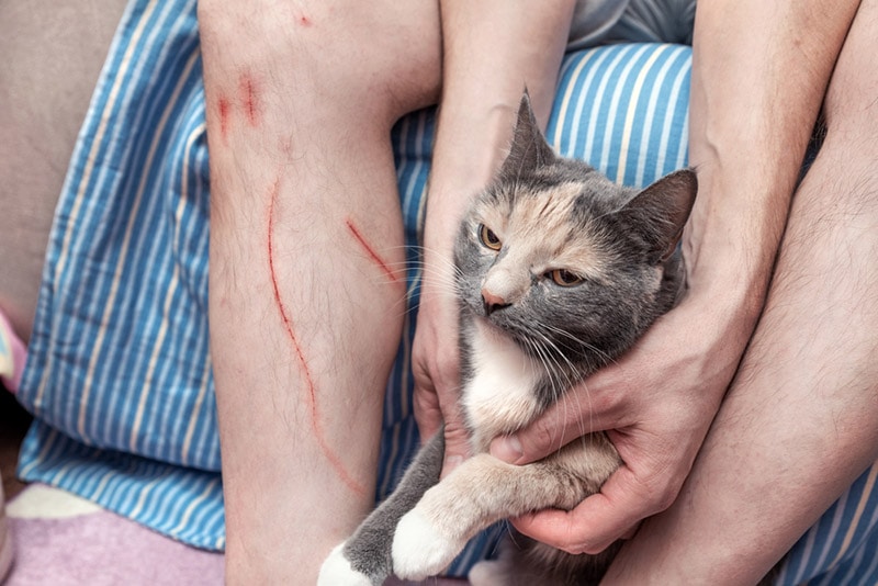 vết thương trên chân của một người đàn ông bởi một con mèo