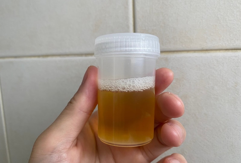 dog urine sample