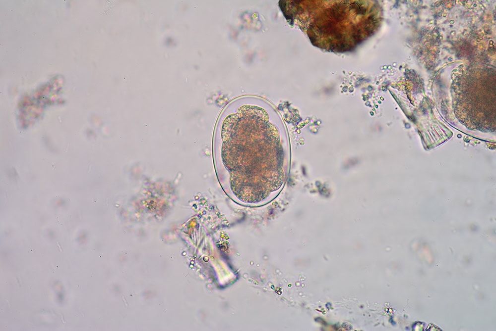 hookworm parasite as seen under the microscope